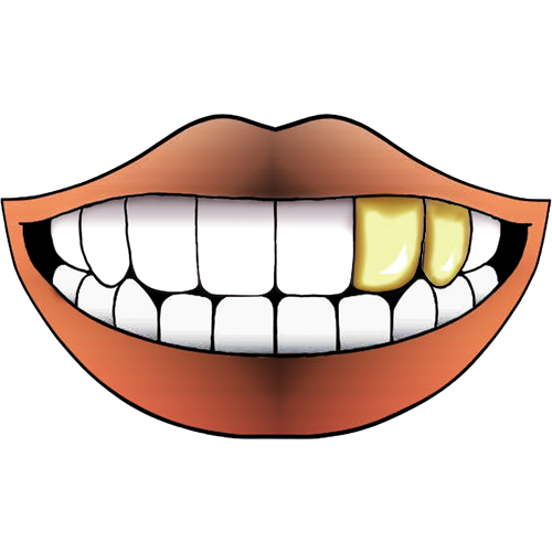 DOUBLE PLATED FLAT GRILLZ