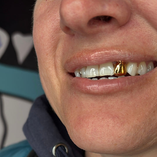 PLATED FLAT GRILLZ