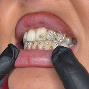 SWAROVSKI® - Guld