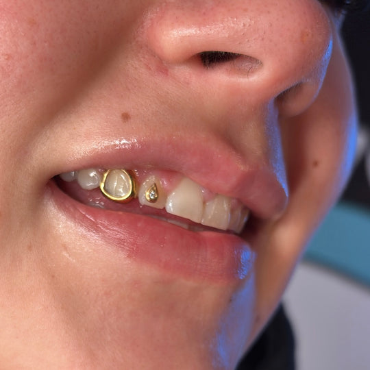 PLATED WINDOW GRILLZ