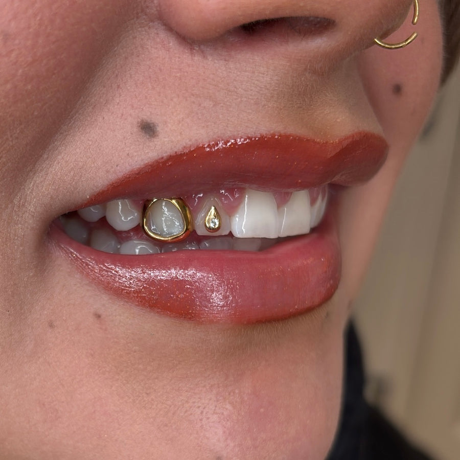 PLATED WINDOW GRILLZ
