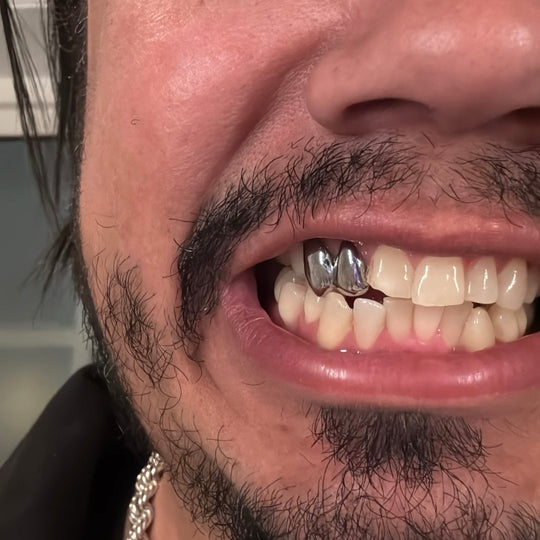 DOUBLE STEEL FLAT GRILLZ