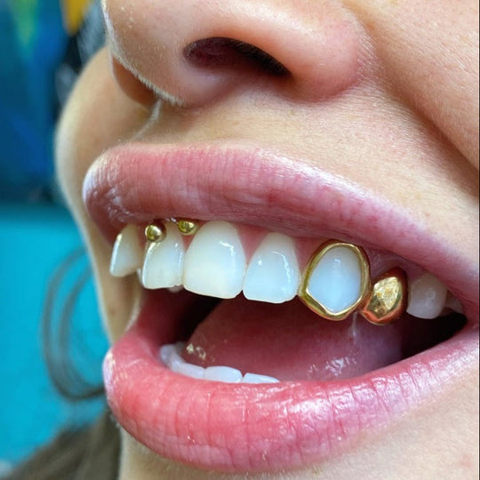 PLATED FLAT+WINDOW GRILLZ