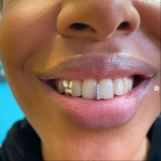 STEEL GAP GRILLZ BLING