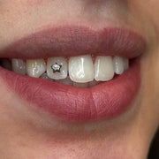 DIAMANT STJÄRNA