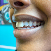 STEEL WINDOW+EDGE GRILLZ