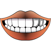 DOUBLE STEEL WINDOW GRILLZ