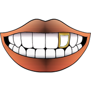 PLATED WINDOW GRILLZ