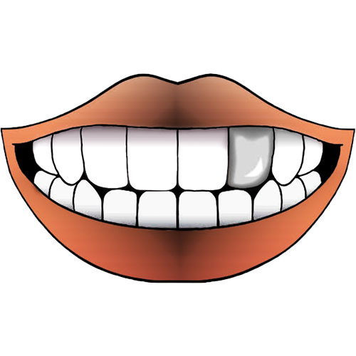 STEEL FLAT GRILLZ