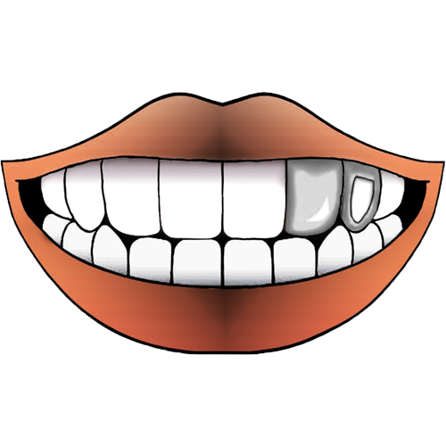 STEEL FLAT+WINDOW GRILLZ