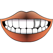 STEEL WINDOW GRILLZ