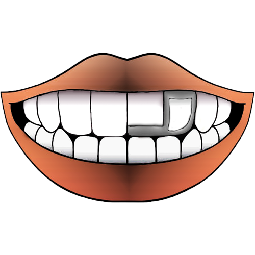 STEEL WINDOW+EDGE GRILLZ