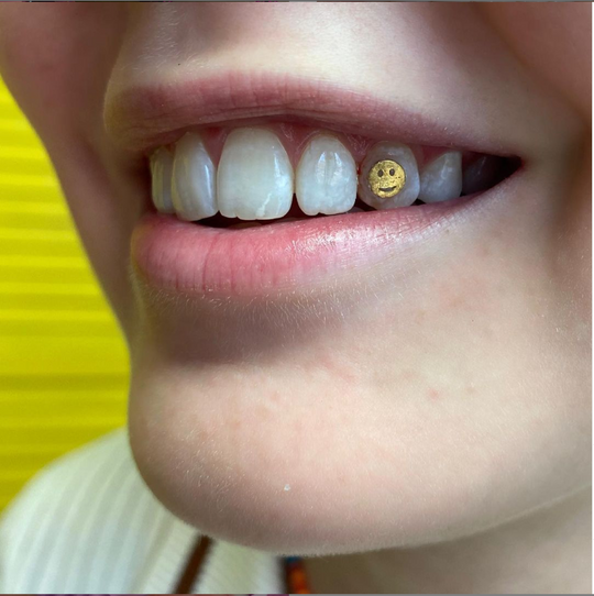 Tandsmycke med designen Smiley i 24k guld