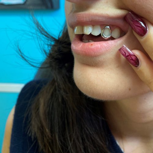STEEL WINDOW GRILLZ